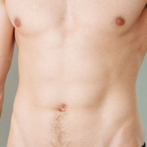 Stomach Archives Medilaser