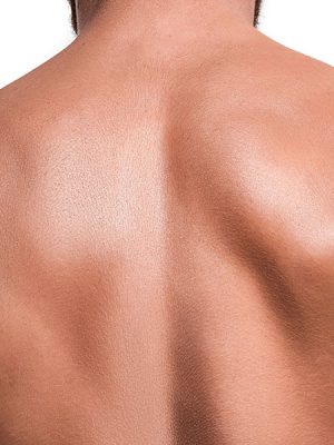 Upper-Back Upper-Back